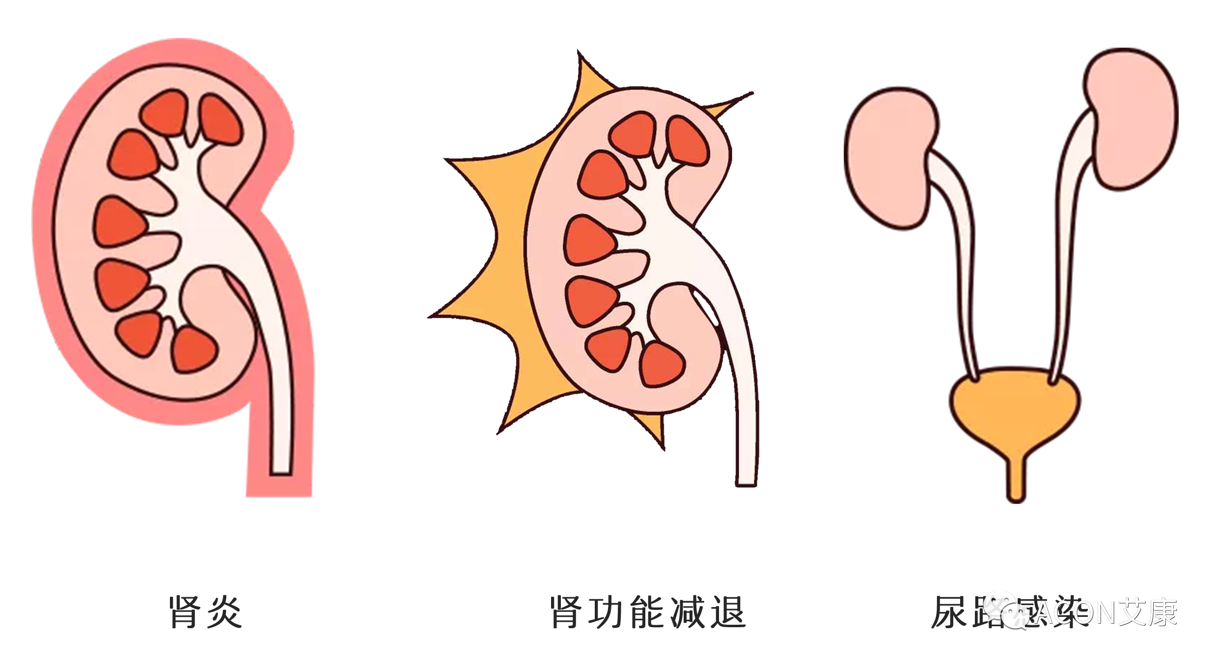 排尿黃、異味大，可能是身體在報警！