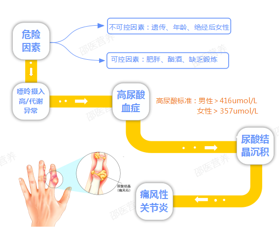 痛風為什么偏愛男性？你最關心的問題都在這里
