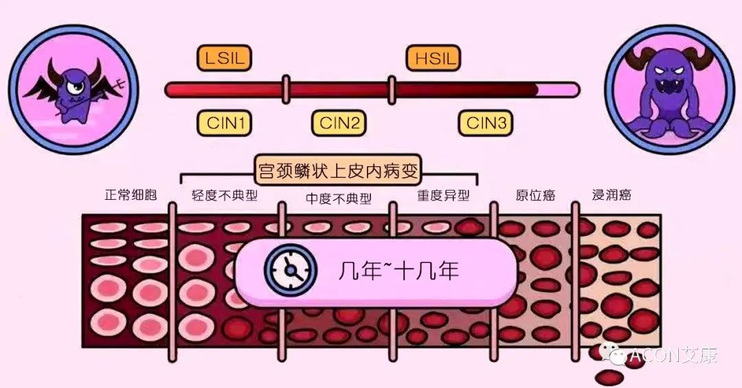全球首次承諾消除一種癌癥，預計到2050年將挽救500萬人的生命