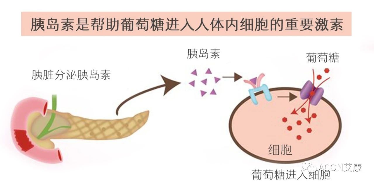爆上熱搜，因爆發(fā)型糖尿病進(jìn)入ICU，有哪些教訓(xùn)值得我們汲取
