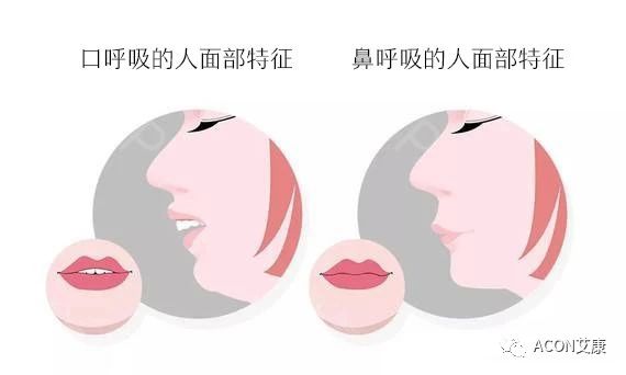 過敏性鼻炎會讓孩子變傻？！家長該如何應對